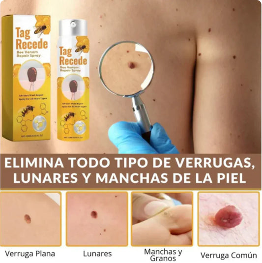 Tag Redece Elimina Verrugas y Manchas en días, sin dolor ni cicatrices 🔥👌🏻 REGALO Especial 2x1 🎁